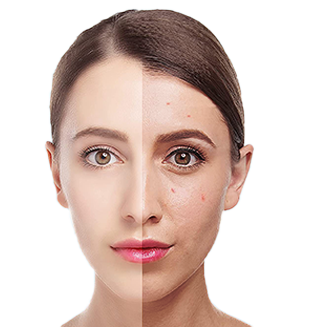 声波洁面仪（images 22）