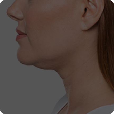 二合一等离子美容仪(images 16)