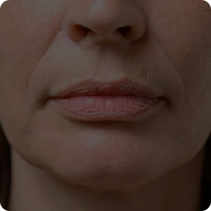 二合一等离子美容仪(images 15)