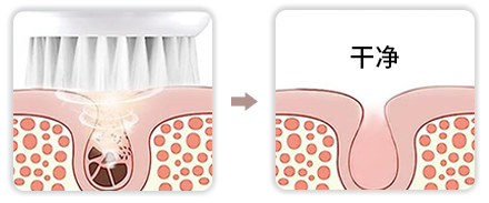 声波洁面仪（images 40）