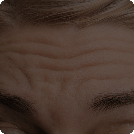 二合一等离子美容仪(images 17)